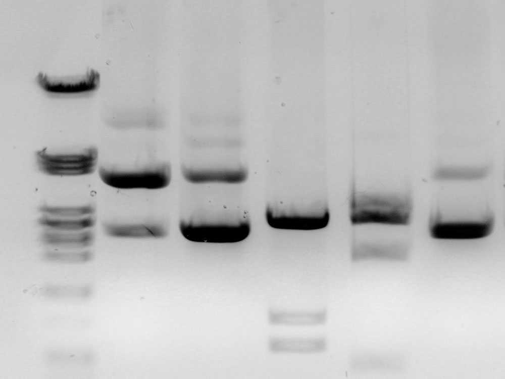 Gel electrophoresis image