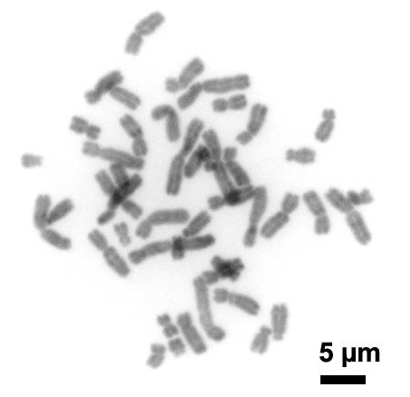 humanchromosomeschromomycina3